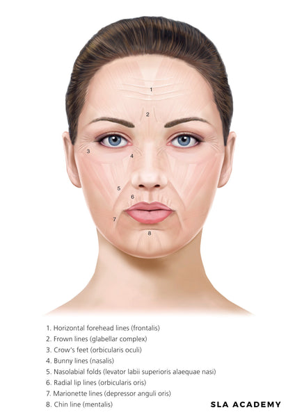 E Download Anti Wrinkle Injection Facial Map Poster SLA Medical